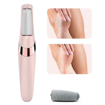 WM Pedicure Callus Remover (Original)