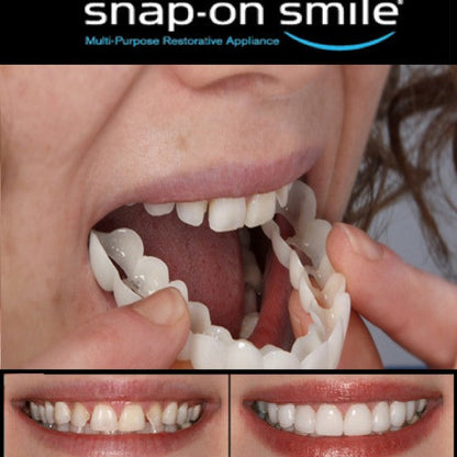 Snap On Smile